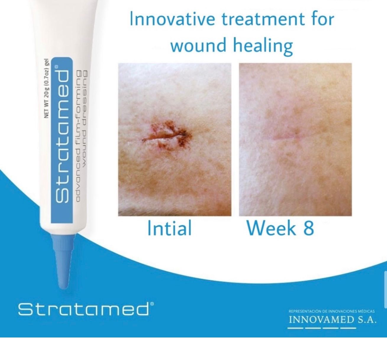 Stratamed® – ღია ჭრილობებისა და პოსტოპერაციული მოვლისთვის